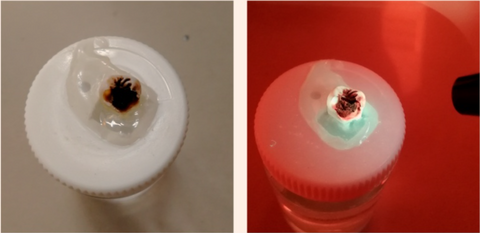 X-cure caries detection